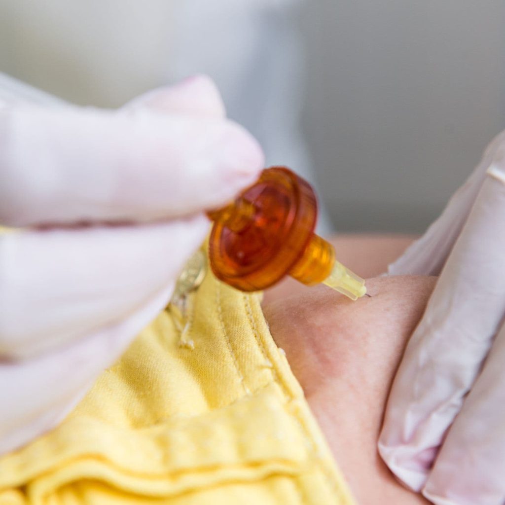 Diferencias Mesoterapia y Carboxiterapia