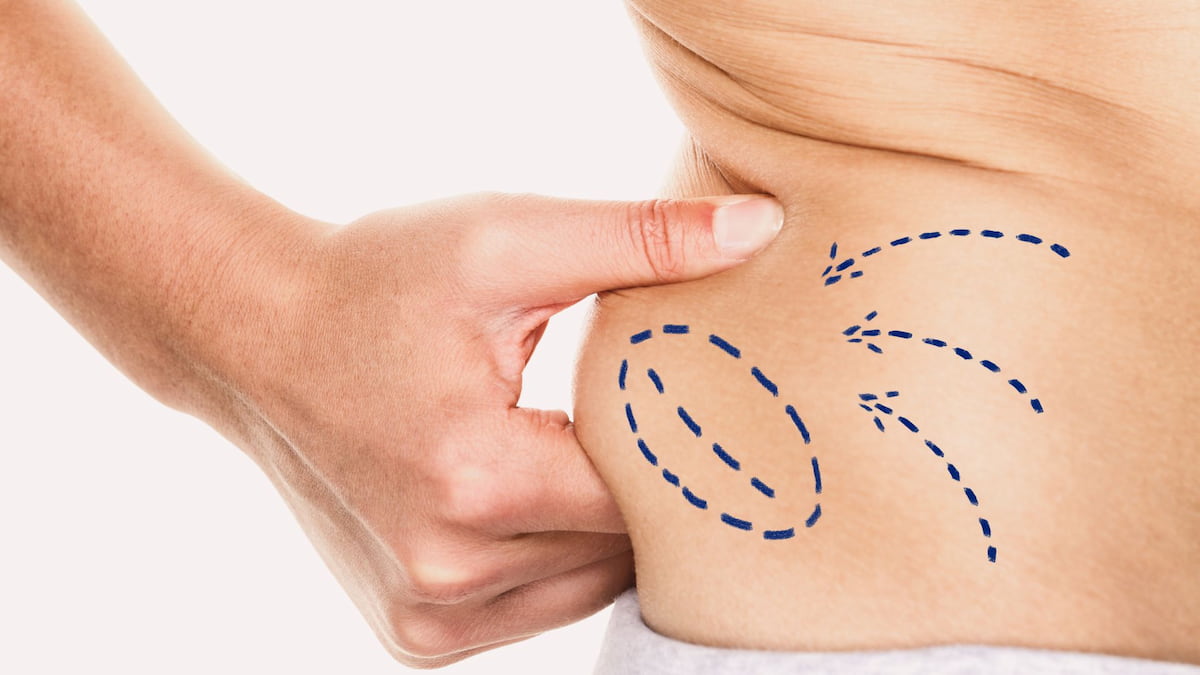 eliminar la grasa abdominal en una mujer