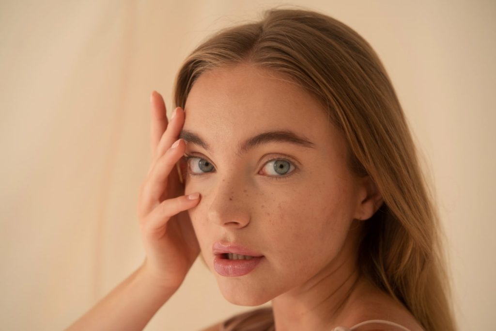 cuidados tras el tratamiento de melasma