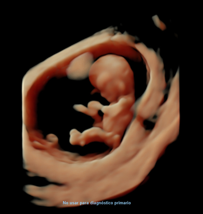 acido folico para embarazadas