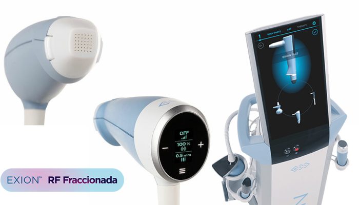 EXION RF fraccionada