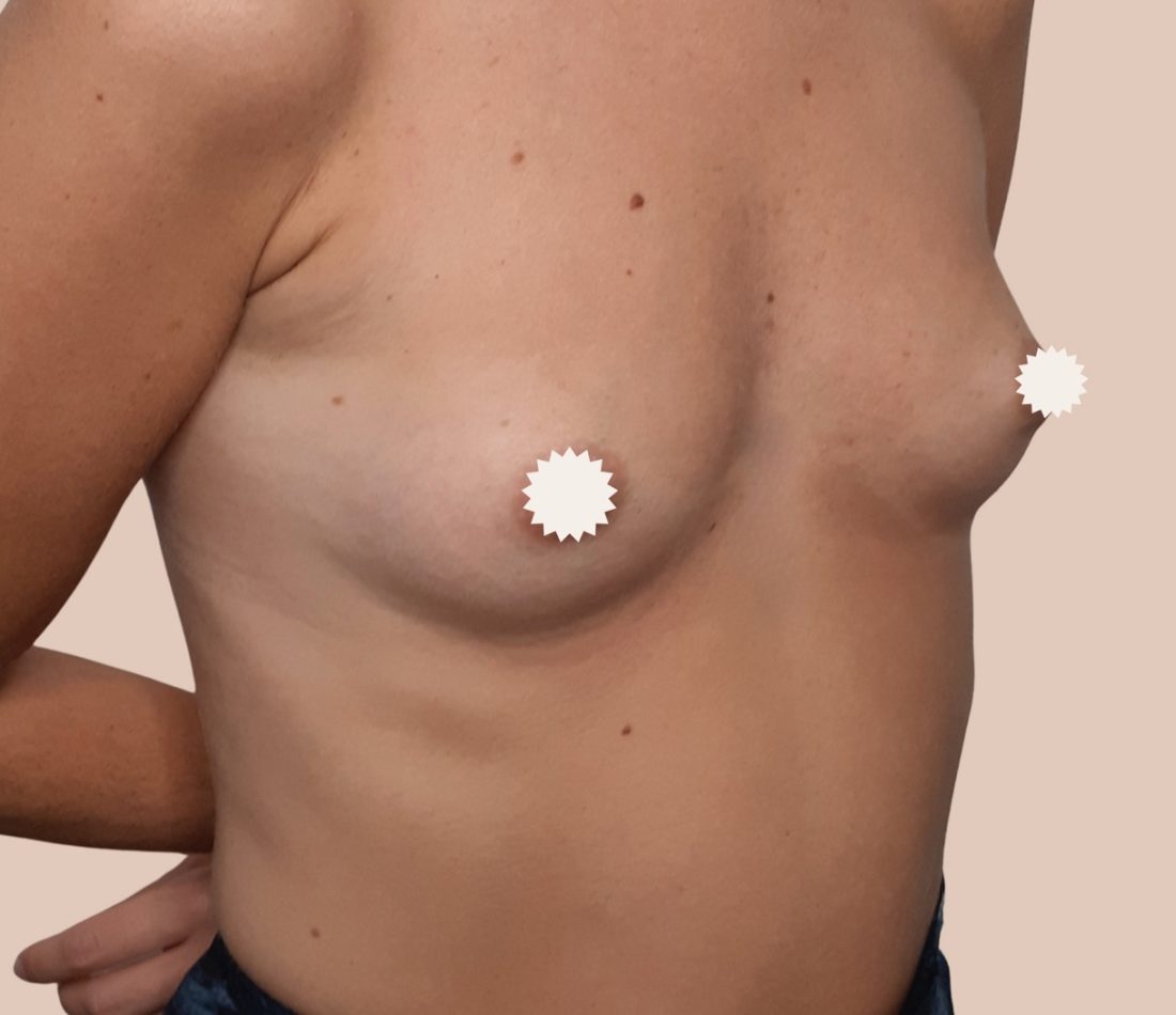 antes3 en tamaño grande