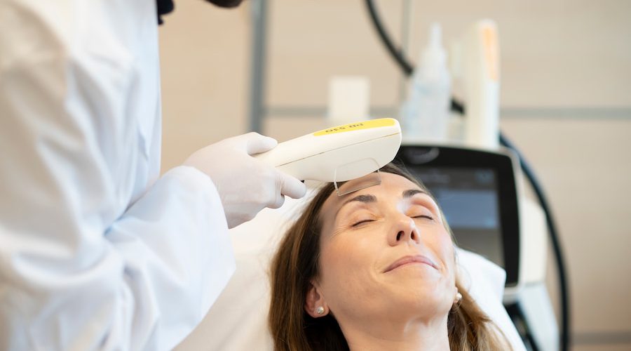 ipl ipl para eliminar rosacea